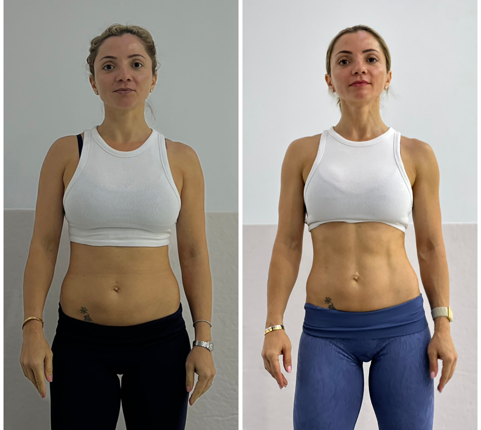 Client transformation before and after photo